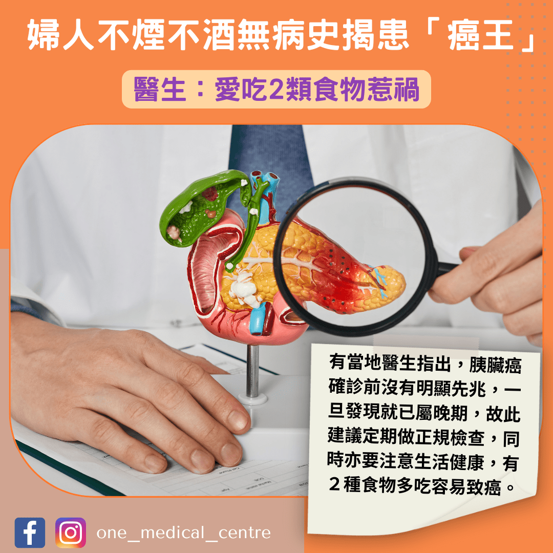 【婦人不煙不酒無病史　食飽胃脹揭患「癌王」　醫生：愛吃2類食物惹禍】